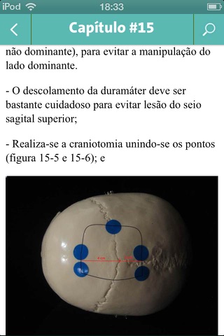 Craniotomy screenshot 2