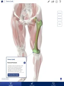 Game screenshot Rehabilitation for Lower Limbs hack