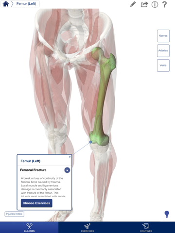 Screenshot #6 pour Rehabilitation for Lower Limbs