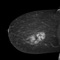 Mammography Flashcards was designed for radiology resident and mammography fellowship education