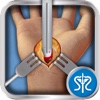 Virtual Carpal Tunnel Surgery