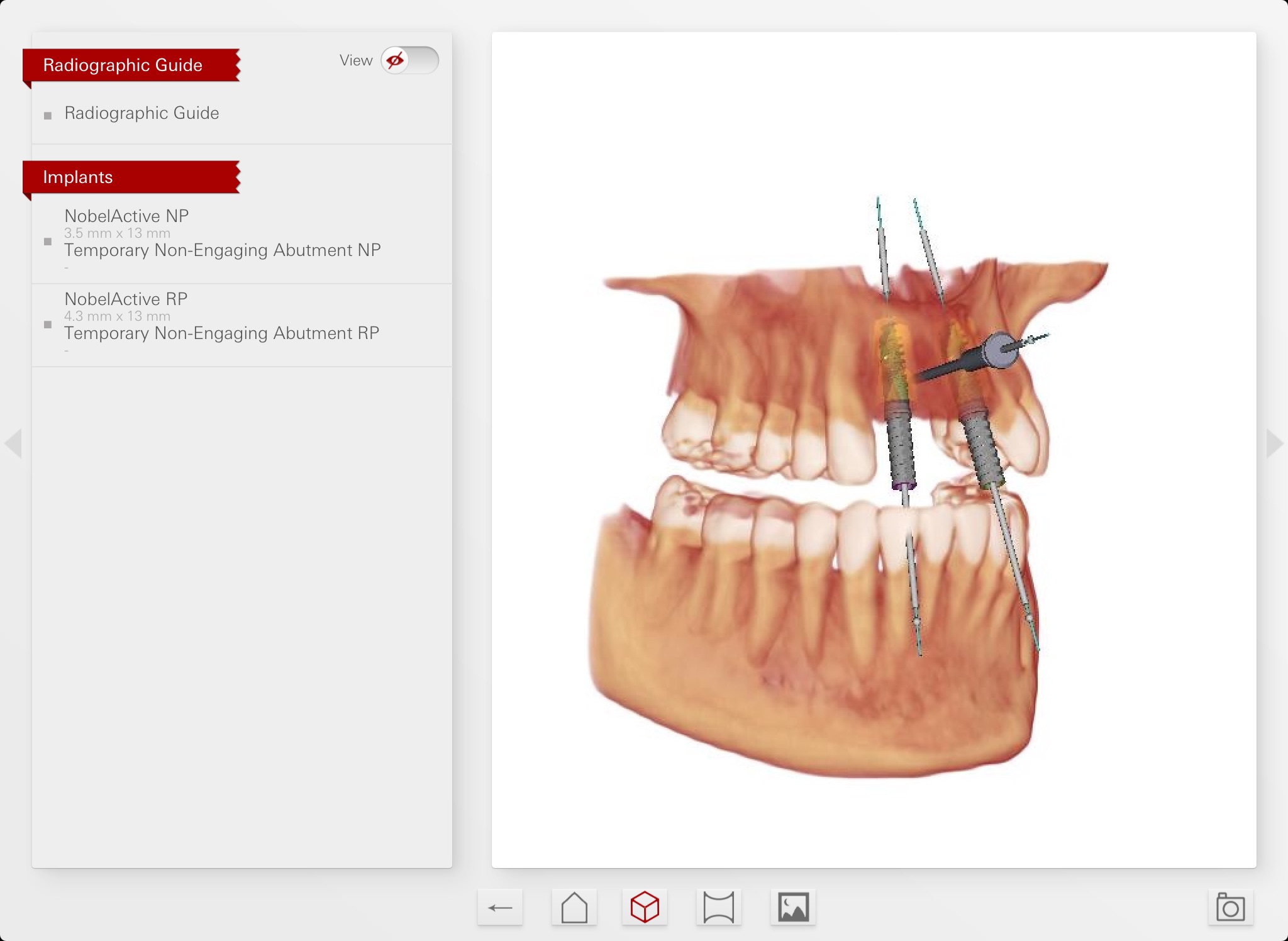 NobelClinician Communicator screenshot 2