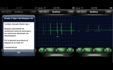 ECG Electrocardiograma Tipos screenshot 3