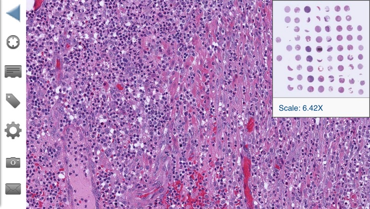 Aperio ePathViewer for iPhone