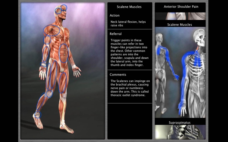 Screenshot #2 pour Muscle Trigger Point Anatomy