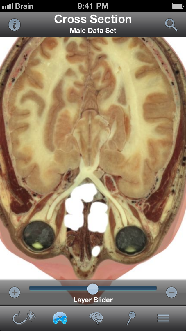 Screenshot #3 pour Pocket Brain - Neuroanatomie Intéractive