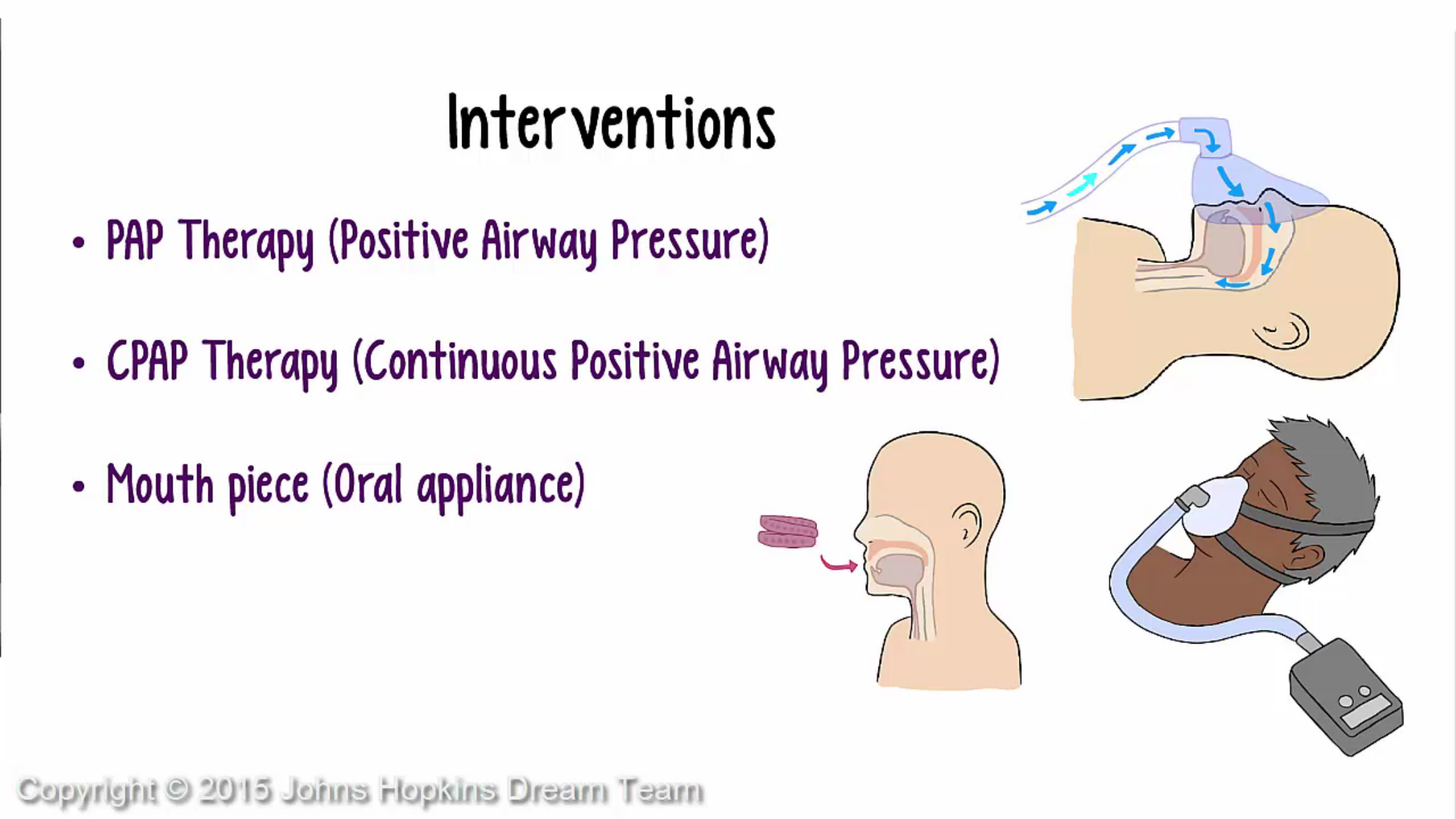 SleepMatters - animated educational modules on sleep disorders screenshot 5