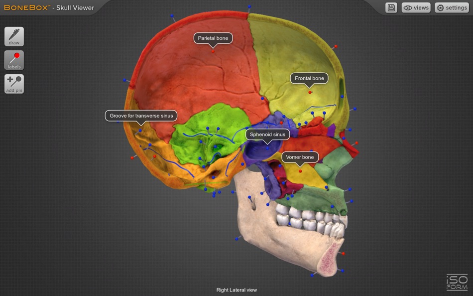 #4. BoneBox™ - Skull Viewer for Mac OS X (macOS) 由: iSO-FORM, LLC