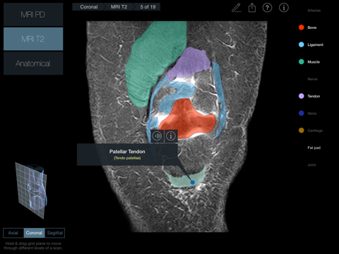 Radiology - Knee screenshot 4