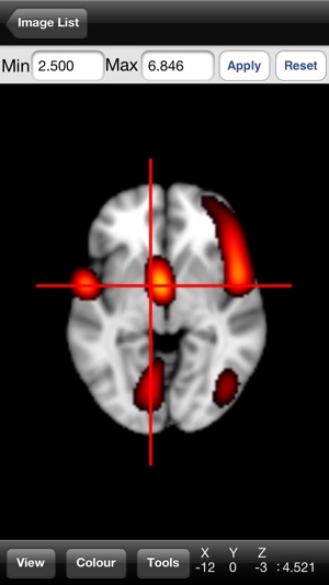 NeuroPub Visualizer(圖3)-速報App