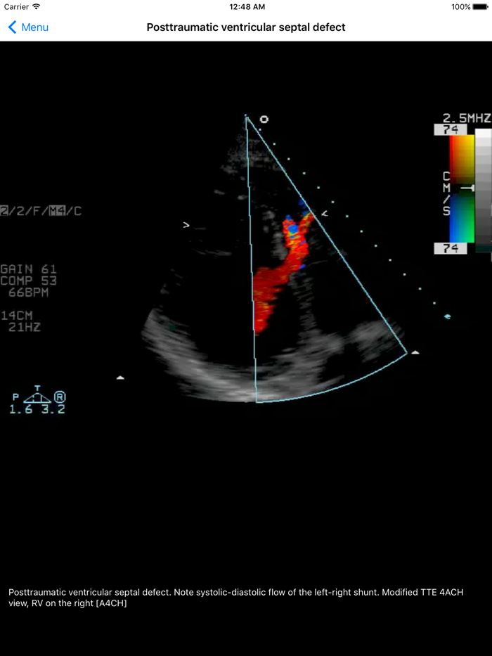 CARDIO3® Comprehensive Atlas of Echocardiography - Lite
