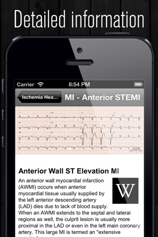 ECG Atlas screenshot 4