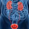 Bladder Cancer:Treatment and Natural Remedies