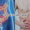 All Colon Cancer