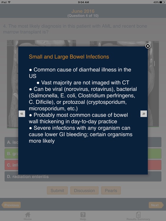 CTisus iQuiz: The HD Edition screenshot-3