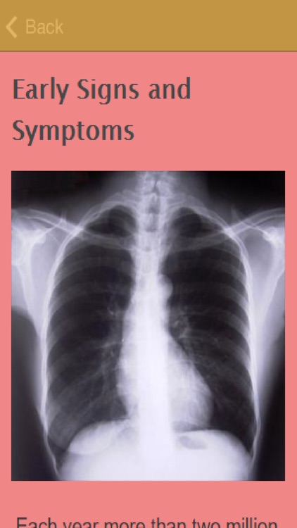 Symptoms Of Pneumonia