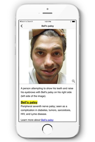 Real Disease - Learn Disease by Real Pictures screenshot 2