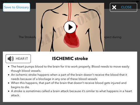 StrokeApp - Helping patients & caregivers become fluent in the language of stroke. screenshot 4