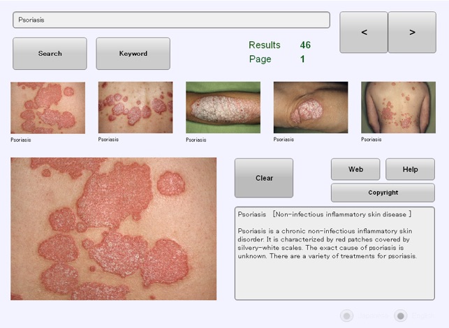 YSP Dermatology Image Database for iPad(圖2)-速報App