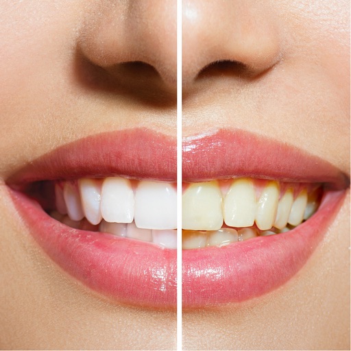 Teeth Whitening Tips - Learn How to Whiten Teeth icon