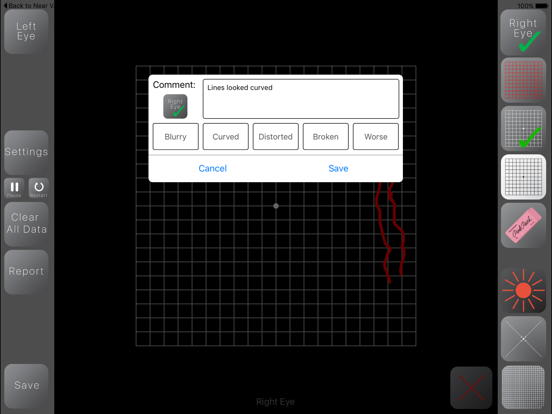 Screenshot #6 pour Amsler 3D