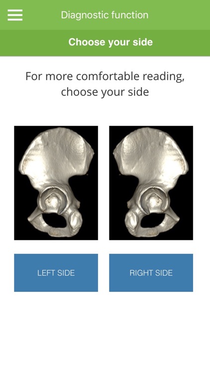 Acetabular Diagnosis Tool