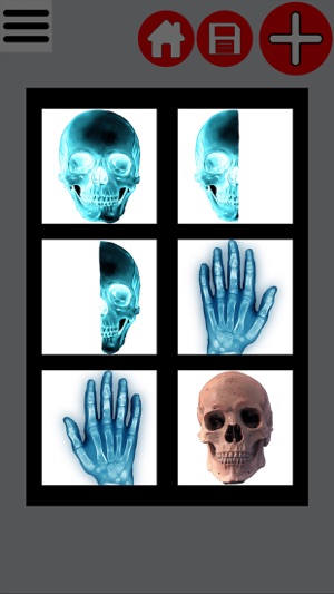 Xray Photo Creator(圖3)-速報App