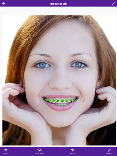 AI Braces Camera Photo Editor