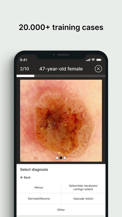 Dermloop Learn Screenshot