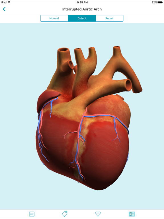 Heartpedia iPad screenshot 4 - Medical app