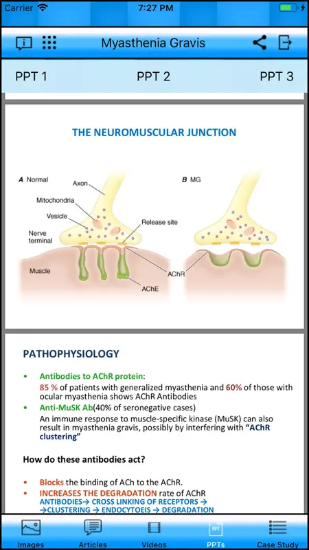 Myasthenia Gravis screenshot 4 of 8
