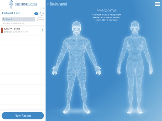Protosthetics Scan & 3D Print