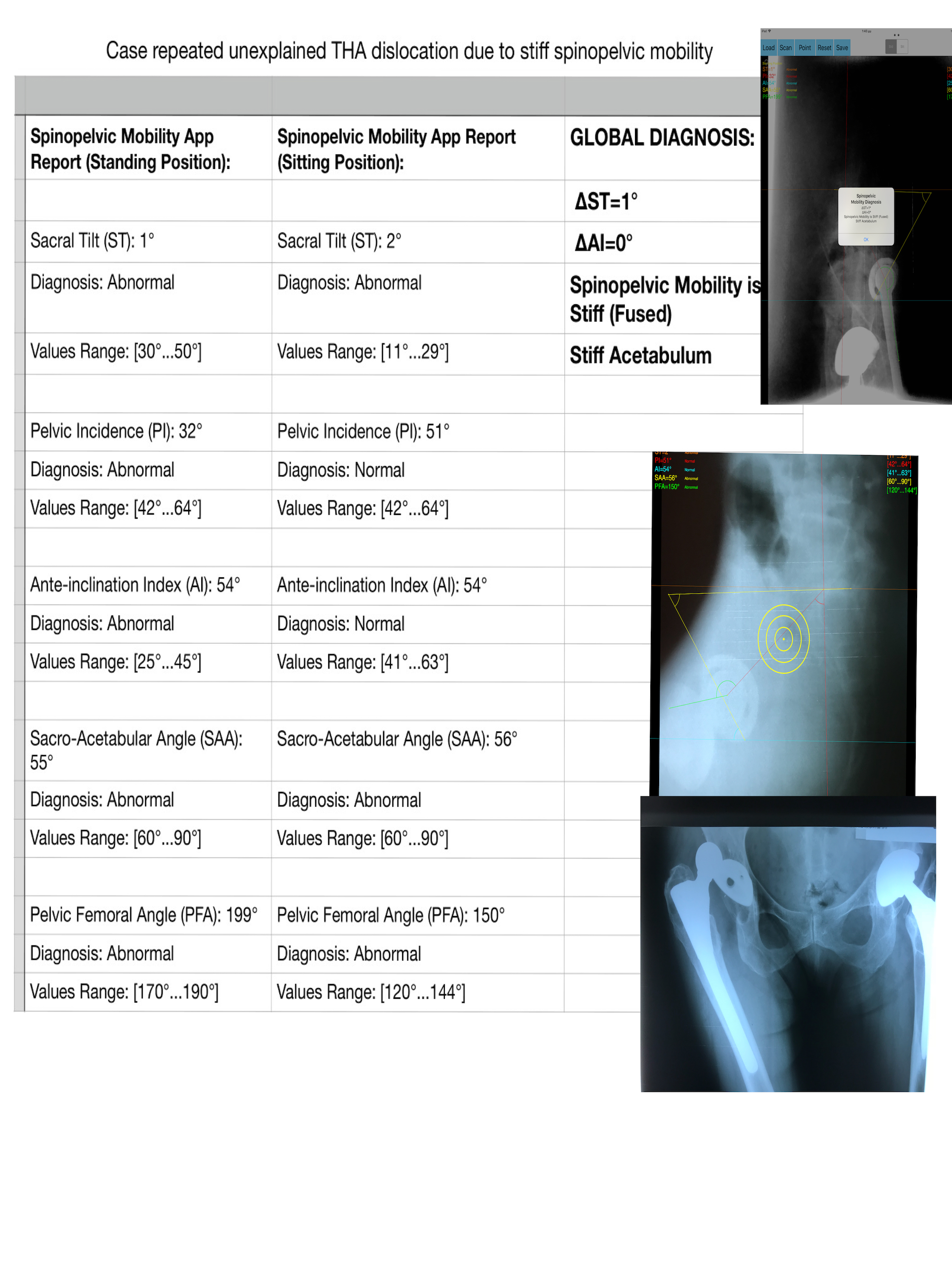 SpinopelvicMobilityApp screenshot 13