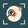 Get Insect Bite ID: AI Scanner for iOS, iPhone, iPad Aso Report