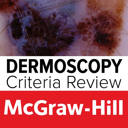 Dermoscopy Criteria Review