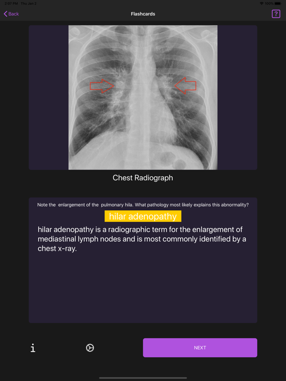 Screenshot #6 pour Basic Radiology