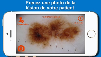 Screenshot #2 pour SkinApp mobile