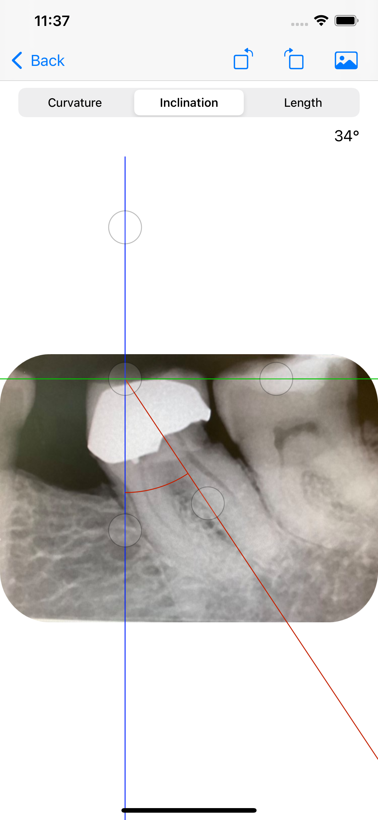 EndoPrep