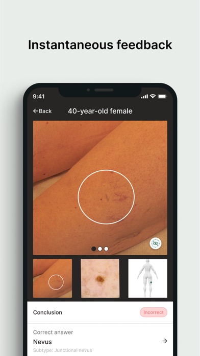 Dermloop Learn Screenshot