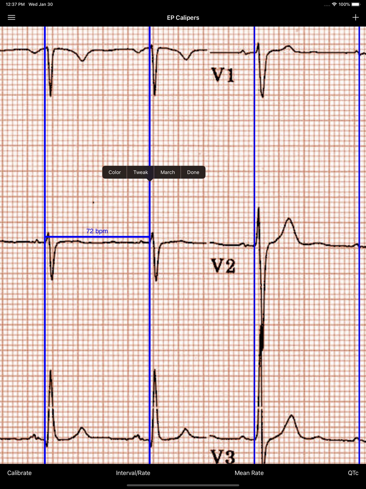 EP Calipers ipad screenshot 3