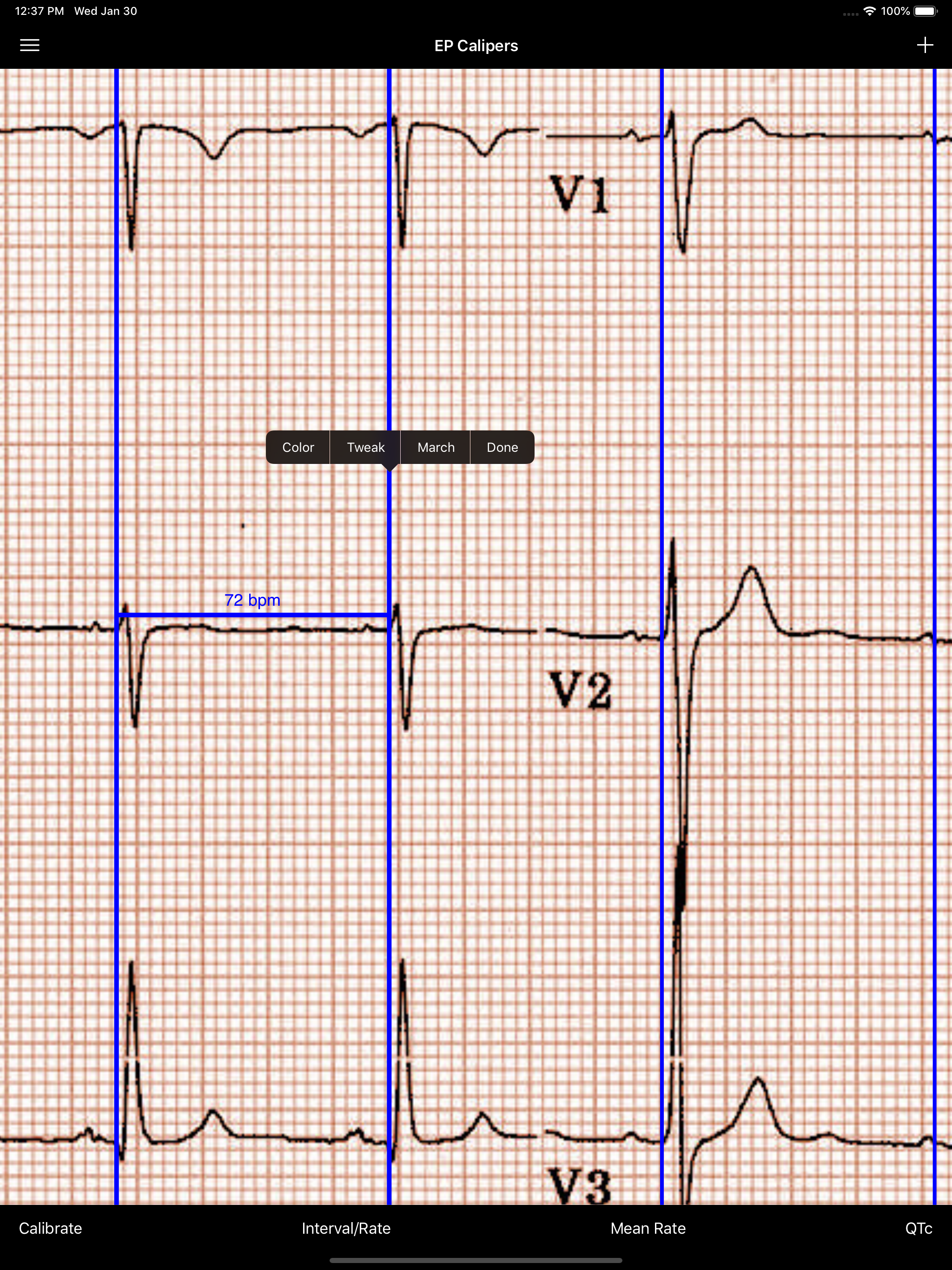 EP Calipers screenshot 10