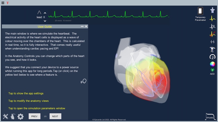 Epicardio Heart Simulator