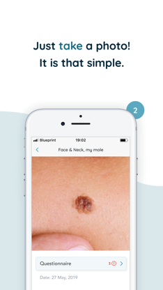 MoleCare - Skin Health Tracker screenshot 2