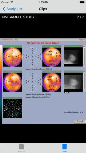 VidistarViewer screenshot 4