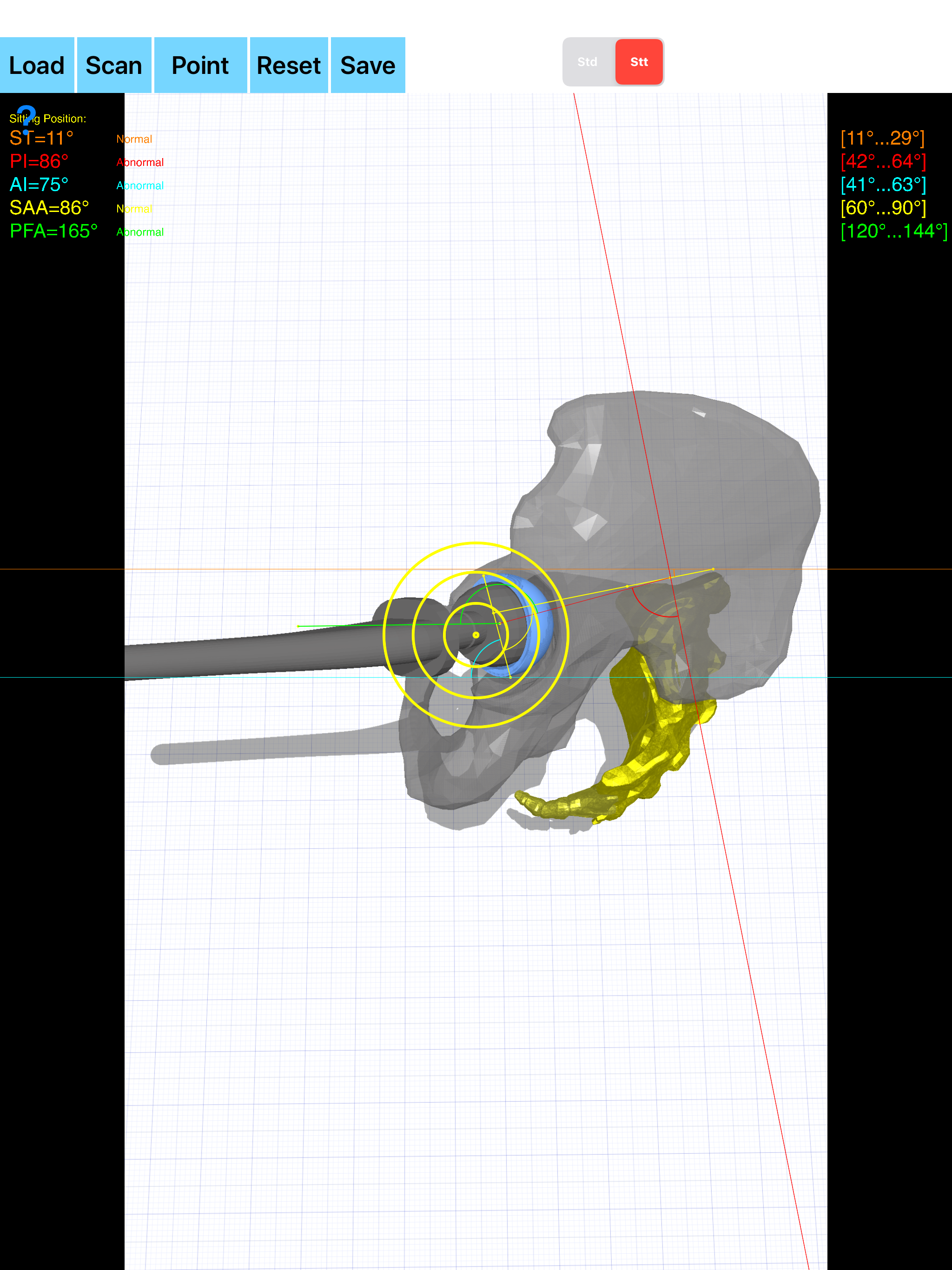 SpinopelvicMobilityApp screenshot 18