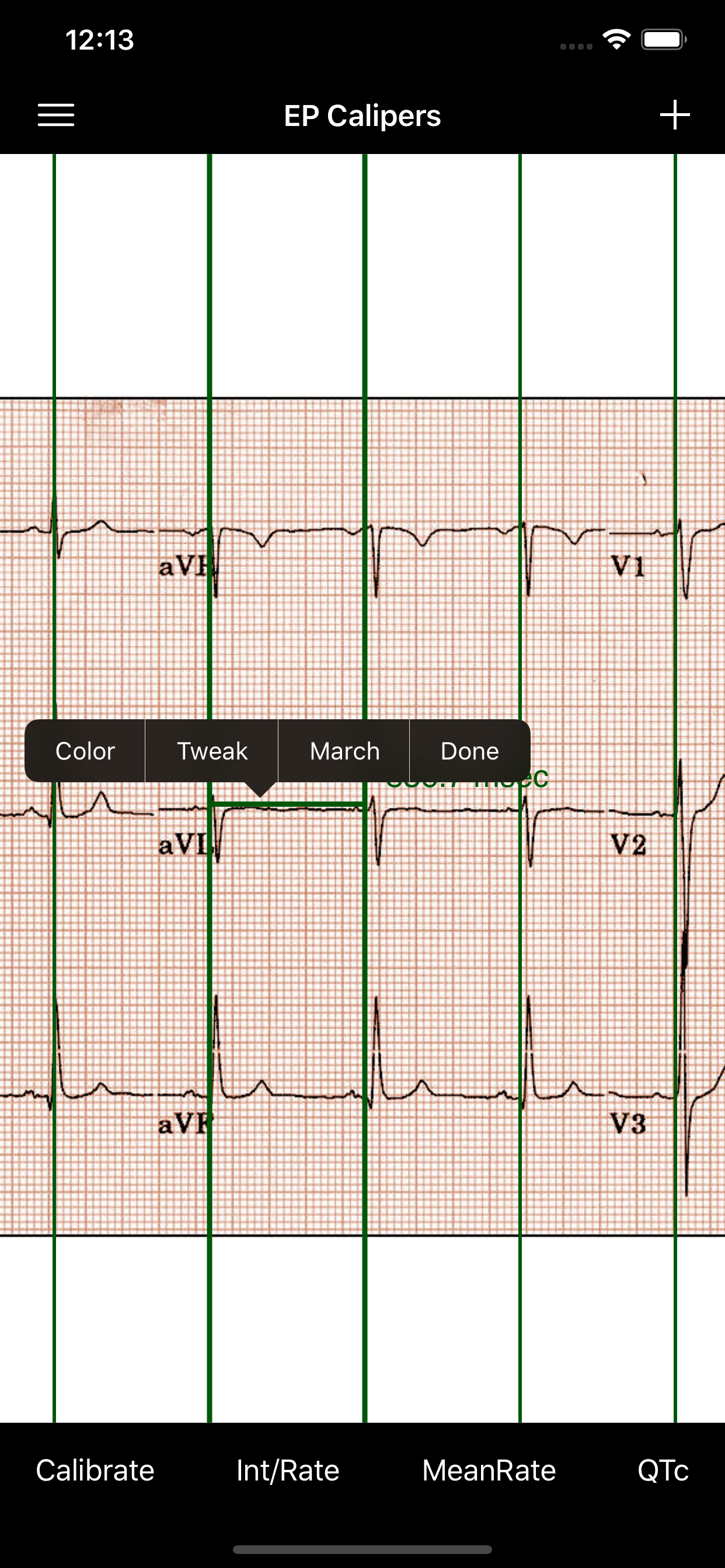 EP Calipers screenshot 6