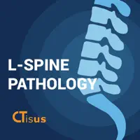CTisus L-Spine Pathology