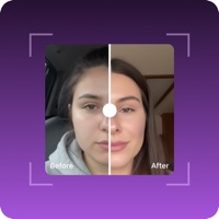 Depuff AI: Reduce Facial Bloat app icon - Health & Fitness app for iPhone