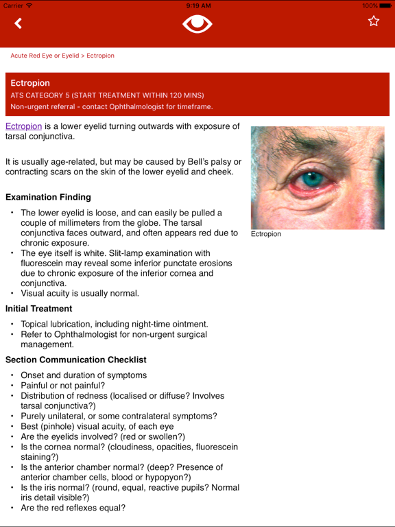 Eye Emergency Manual iPad screenshot 4 - Medical app