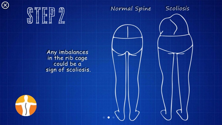 Scoliometer screenshot-6